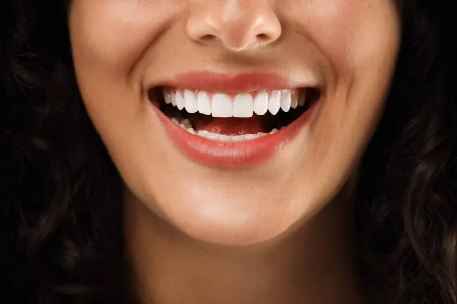 Close-up of a person's smile showing straight, white teeth.